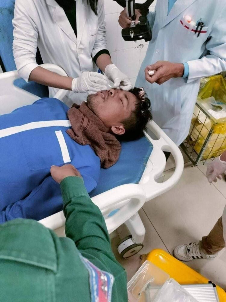 The victim’s right eyeball has been removed after he was struck by a prison officer. (Um Sam An’s Facebook)